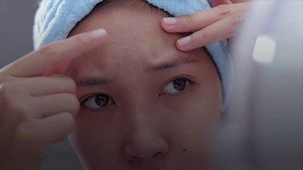 4 Foods That Could Be Causing Your Breakouts