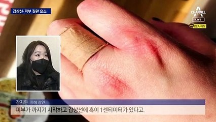 악취 60배·독성물질 3배…그래도 환기 규정이 없다