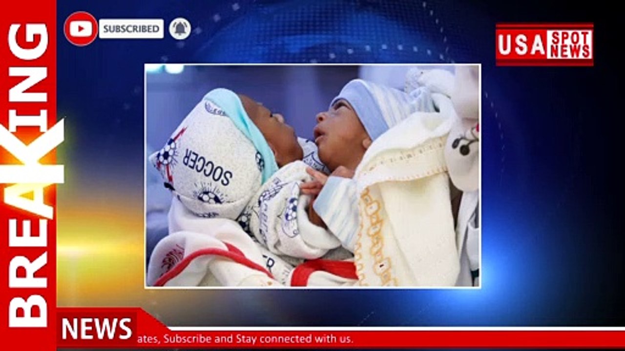 Conjoined twins fly to Jordan for separation surgery