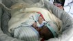 UNICEF Airlifts Yemeni Conjoined Twins to Jordan For Specialized Medical Care-Video