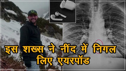 सीने में दर्द की शिकायत के बाद अस्पताल पहुंचा शख्स, X-ray रिपोर्ट देख उड़े सबके होश!
