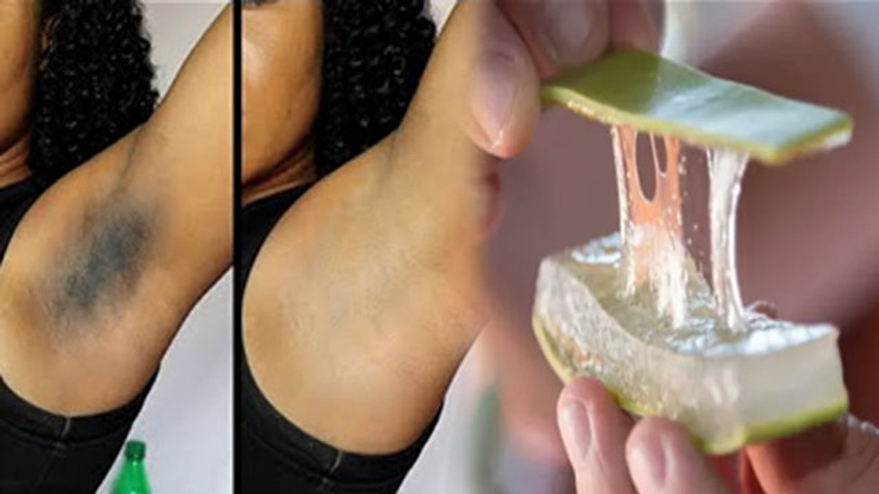 एलोवेरा से दूर करें अंडरआर्म्स का कालापन | Aloe Vera Se Dur Kare Under Arms Ka Kalapan | Boldsky
