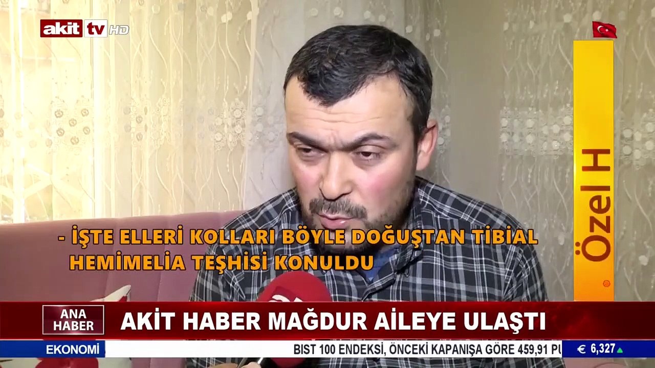 1,5 yaşındaki bebeğin yürek burkan dramı...