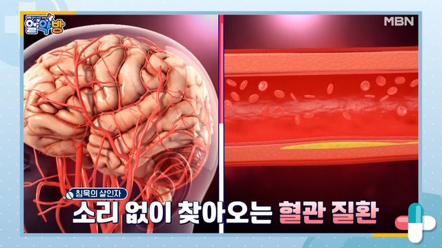 알약방 33회 [혈관 속 중성지방을 낮추고, 혈관 질환을 예방하라!]