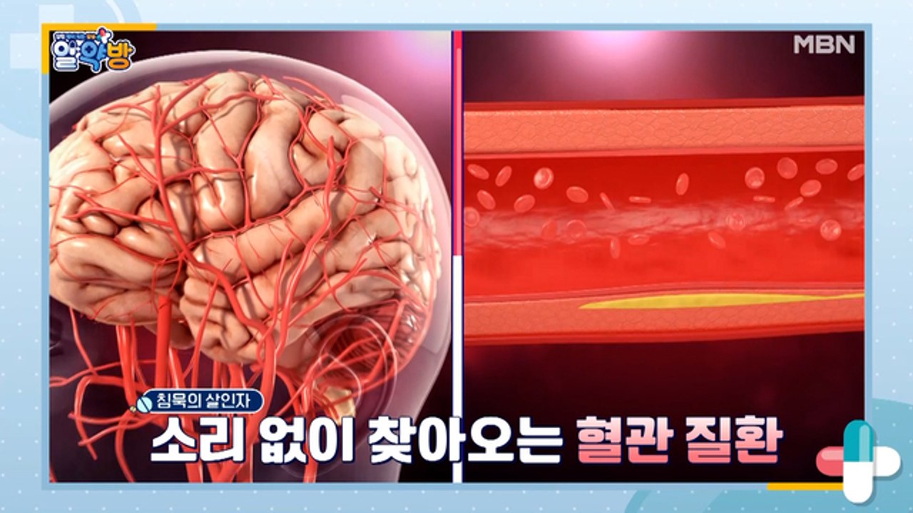 알약방 33회 [혈관 속 중성지방을 낮추고, 혈관 질환을 예방하라!]