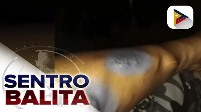 MALASAKIT AT WORK: Binata sa Valenzuela na may chronic kidney disease, nanawagan ng tulong-medikal; DSWD-NCR at Valenzuela City LGU, magbibigay ng tulong