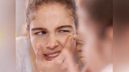 मुंहासे चेहरे पर निकल आएं हैं तो भूलकर भी ना करें ये गलतियां । Skin Care Tips । Boldsky