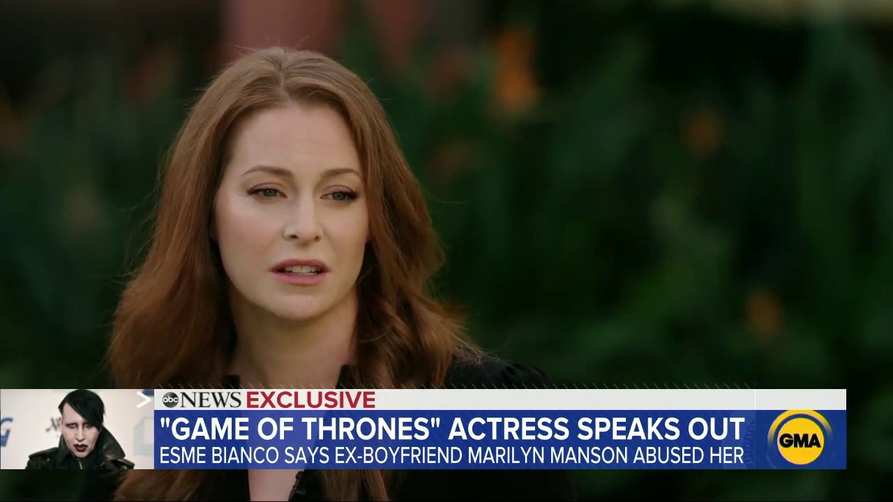 "Game of Thrones" actress claims alleged abuse by ex-boyfriend Marilyn Manson