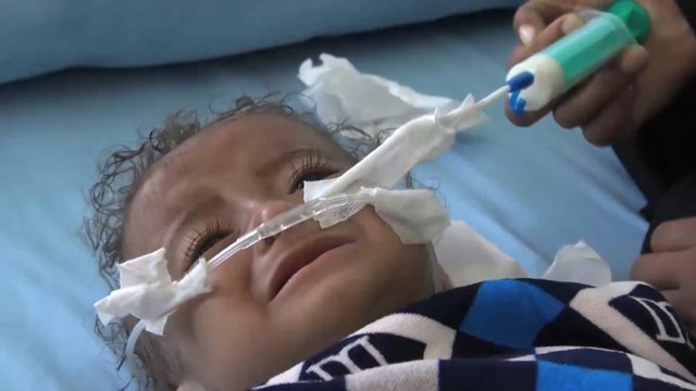 4 منظمات أممية: نصف أطفال اليمن مهددون بسوء التغذية