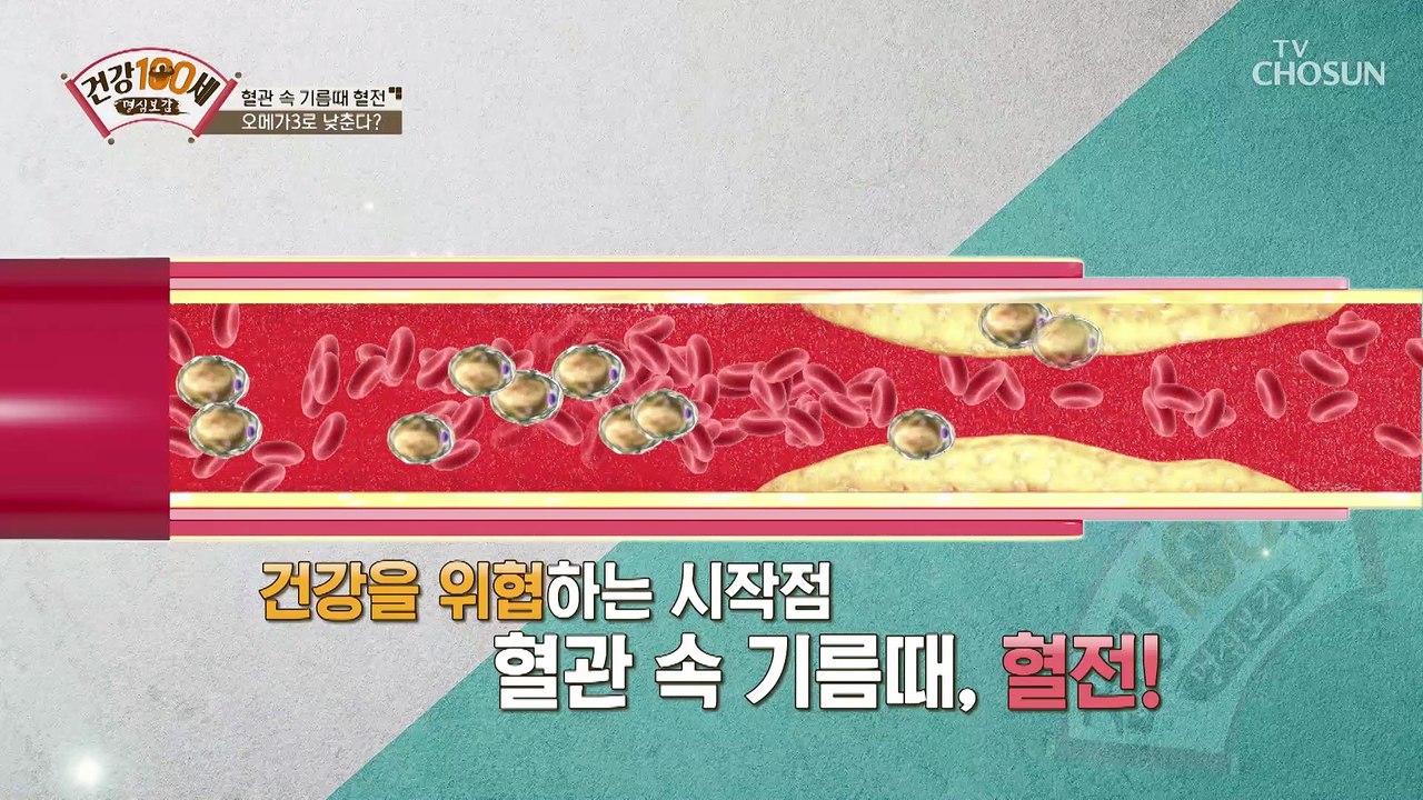 침묵의 살인자☠ 고혈압·고지혈증·당뇨에 대한 모든 것 TV CHOSUN 210215 방송