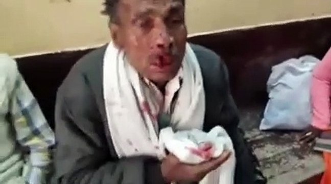 शाहजहांपुर: टेंपू की आमने सामने टक्कर से एक दर्जन घायल, दो की हालत गंभीर