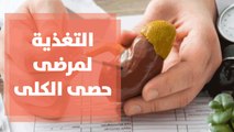 التغذية المناسبة لمرضى حصى الكلى