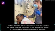Gorilla Glue Craze: Man Sticks Cup To Face, Has To Go Through Emergency Surgery | Viral Video