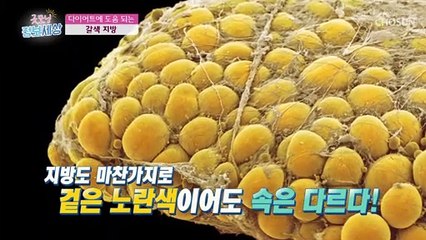 지방에도 종류가 있다! 살이 빠지는 ‘○○지방’ TV CHOSUN 210217 방송