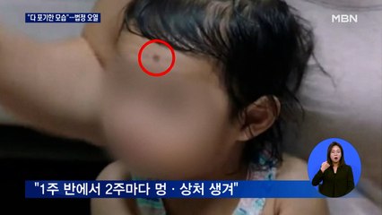 "야위어간 정인이, 사망 전날 모든 것을 포기한 느낌"