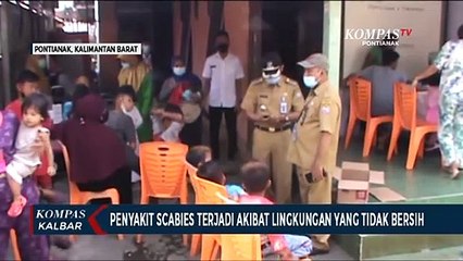Agar Scabies tak Meluas, Dinkes Minta Masyarakat Jaga Kebersihan Lingkungan