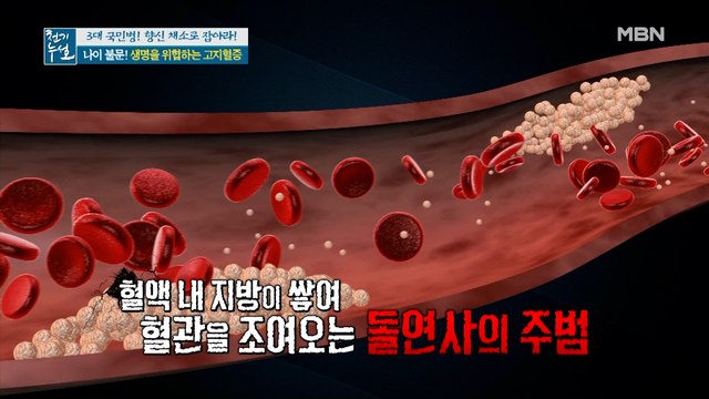 나이 불문! 생명을 위협하는 고지혈증!