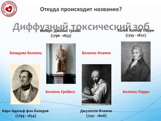 5 минут о том, что такое Базедова болезнь