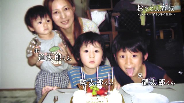 おひさま家族 りんくん一家10年の記録 第35回民教協スペシャル 色素性乾皮症は進行性の病で30歳を過ぎると生涯を終える病です 色素性乾皮症は 紫外線を浴びると皮膚に火傷のような症状が出て やがて皮膚がんを患ってしまう病気で 神経障害も伴い30歳位までしか