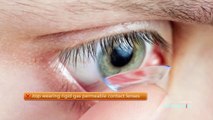 LASIK surgery information | Ophthalmology Videos | Practice Online Education