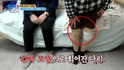 다리 모양 변화는 관절염 신호?! O다리 주의보~!!