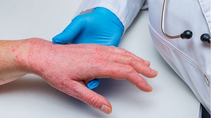 Australia is experiencing the rise of a flesh-eating disease