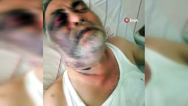 Darp iddiasıyla hastanelik olan yüzde 90 engelli vatandaş olayında flaş gelişme