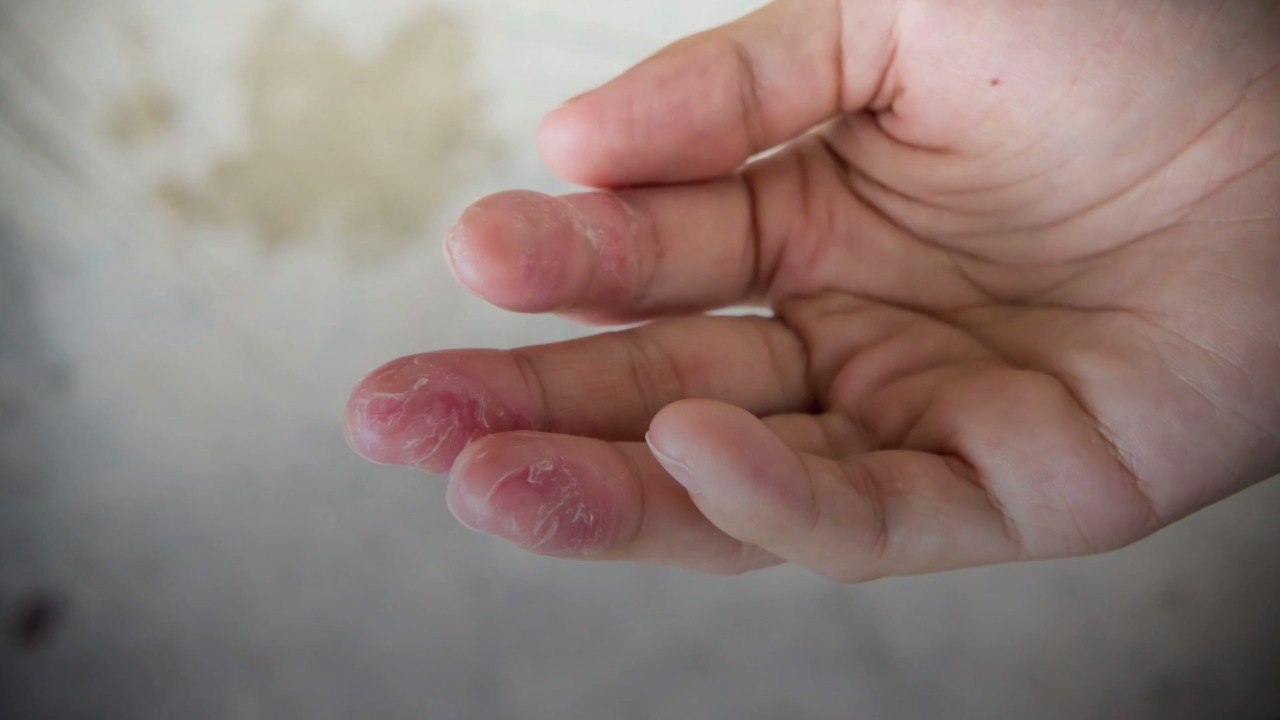 Protect Your Dry Winter Hands With These $10 Scrubbing Gloves