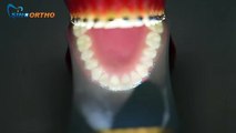 Dental Mirror Defogger | Anti Fog Dental Mirror | Dental Mirror With Lights | Fog Free Dental Mirror -  Sinoortho.com