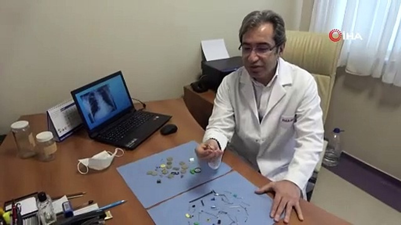 Hepsi insan vücudundan çıkartıldı, çividen jetona kadar her şey var