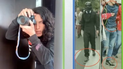 Manifestante herido en jornada de protesta en Bogotá perdió un ojo