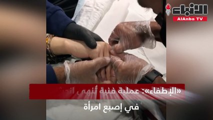 «الإطفاء» عملية فنية تُنهي انحشار خاتم في إصبع امرأة