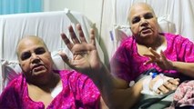 Rakhi Sawant Mother Jaya का Tumor Operation से पहले Salman Khan को Thank You Video | Boldsky