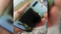 Uyurken cep telefonu patladı!