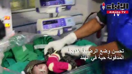 تحسن وضع الرضيعة المدفونة حية في الهند