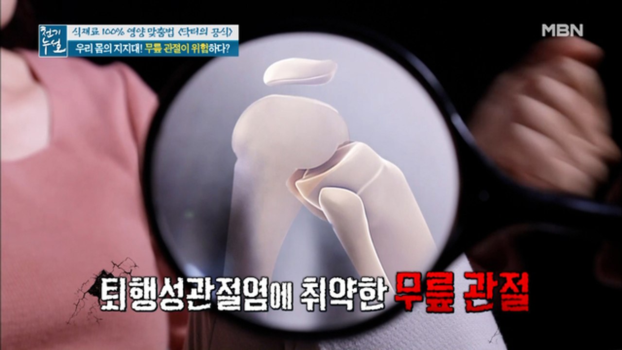 우리 몸의 지지대! 무릎 관절이 위험하다?