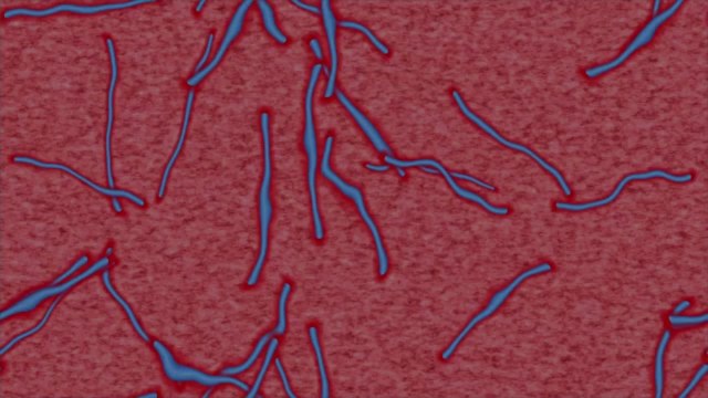 CDC Implements Travel Restrictions for Countries With Ebola Cases