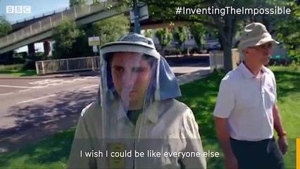 شاب بريطاني قد يموت اذا تعرض لضوء الشمس وهذا القناع أنقذه