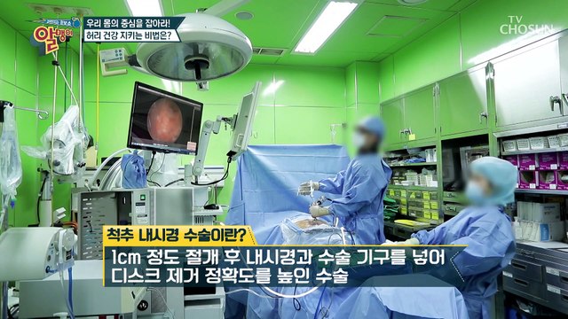 (궁금) 허리 디스크를 완전 정복한 주인공의 비결은?! TV CHOSUN 20210228 방송