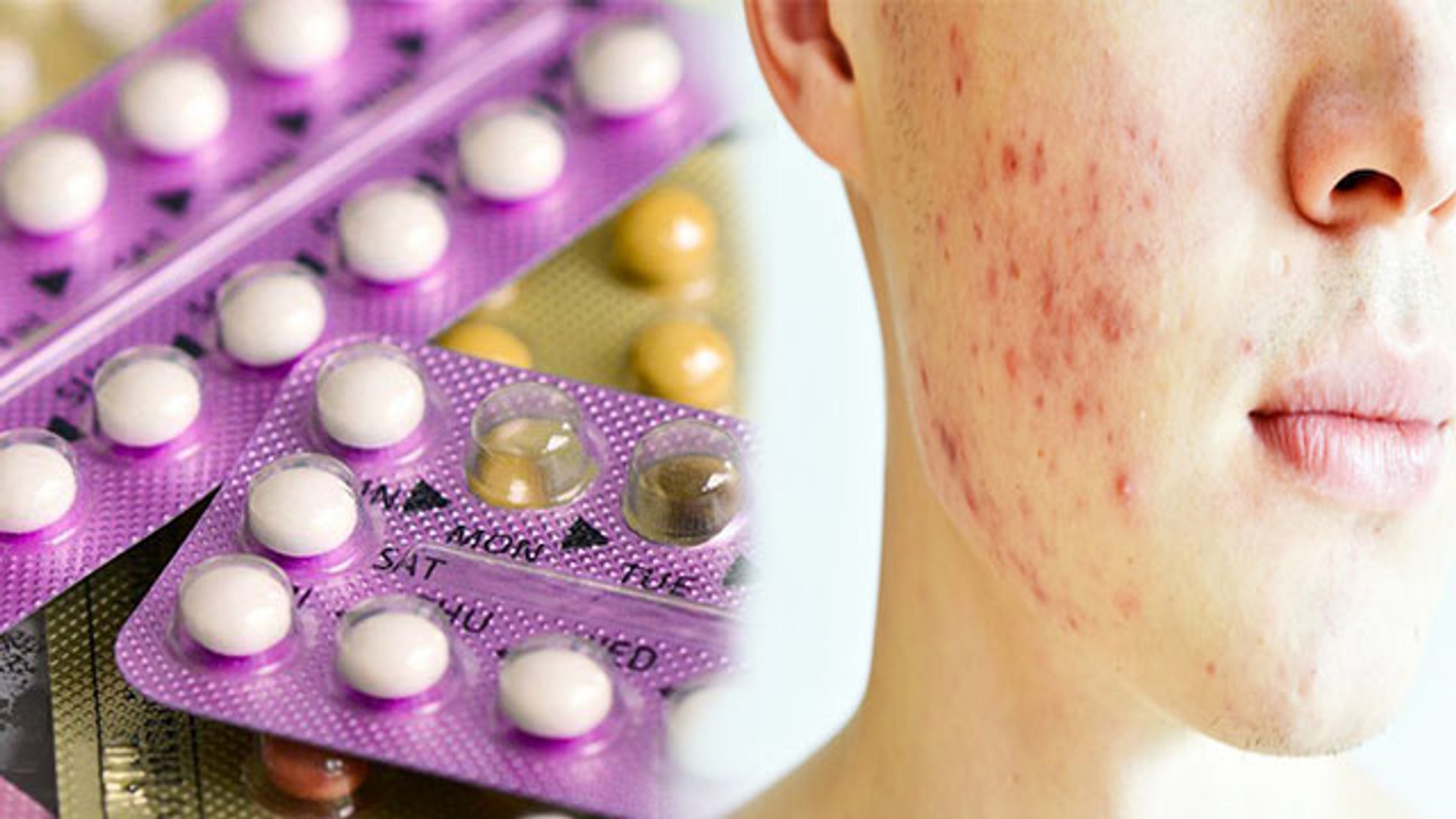 ⁣Contraceptive Pills बिगाड़ सकती हैं आपका चेहरा, हो सकता है Skin Infection | Boldsky