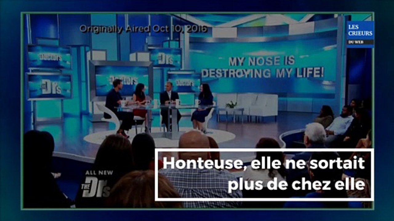 Cette mère de famille est vraiment belle après une chirurgie réparatrice, avant, elle n’osait plus sortir de chez elle