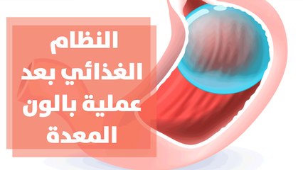 ما هو النظام الغذائي بعد عملية بالون المعدة؟