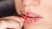 होंठ फटने के कारण। होंठ फटने से कैसे बचाएं । Chapped Lips Causes। Boldsky