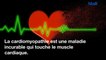 Quels sont les symptômes de la cardiomyopathie ?