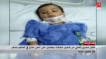 تفاصيل حصول طفل مصري على أغلى علاج فى العالم بسعر 34 مليون جنيه