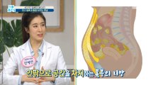 [HEALTHY] 43 causes of the disease! Full-body illness and pain called belly fat., 기분 좋은 날 20210303