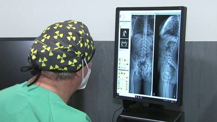 Llega a España el primer escáner con menor radiación que una radiografía convencional