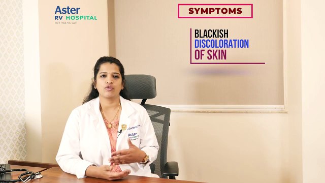 How to get Pregnant - Polycystic Ovary Syndrome (PCOS) - Dr. Smrithi D Nayak -