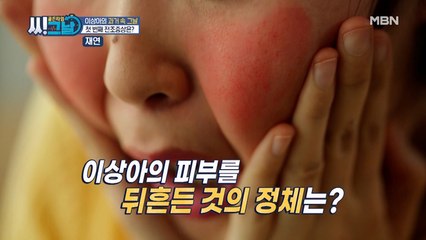 ※충격※ 이상아의 피부를 뒤흔든 것의 정체는?