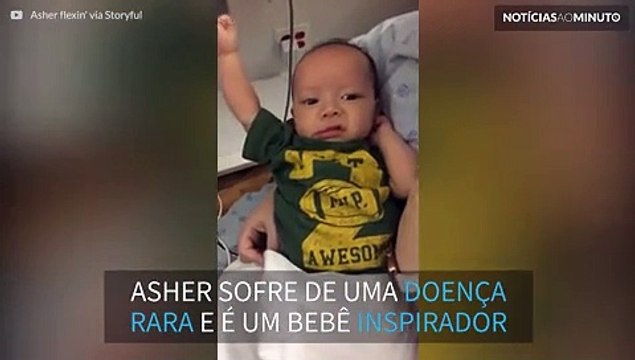 Após 3 cirurgias, bebê com doença rara mostra muque para mãe